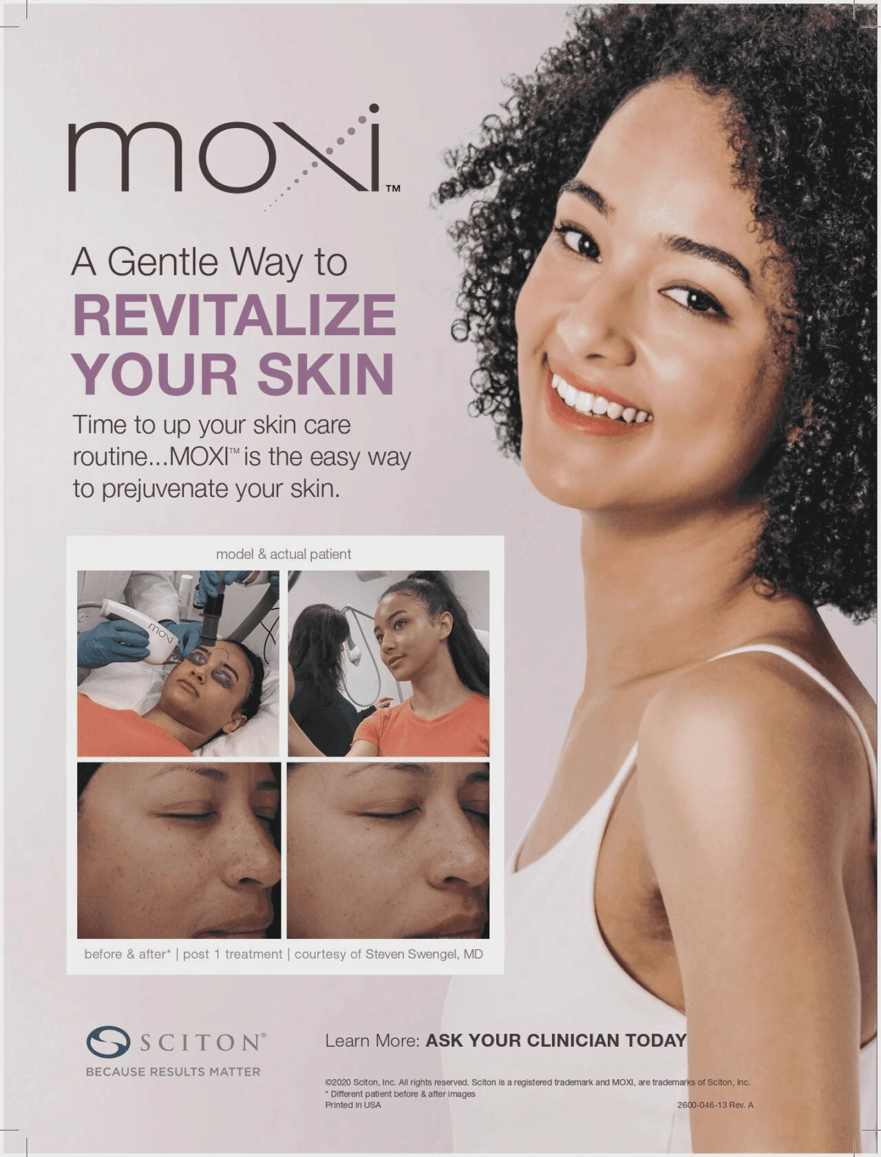 Moxi Treatment Moxi Treatment