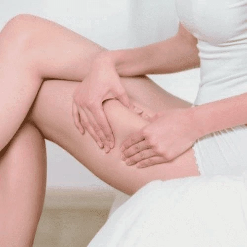 Cellulite Reduction
