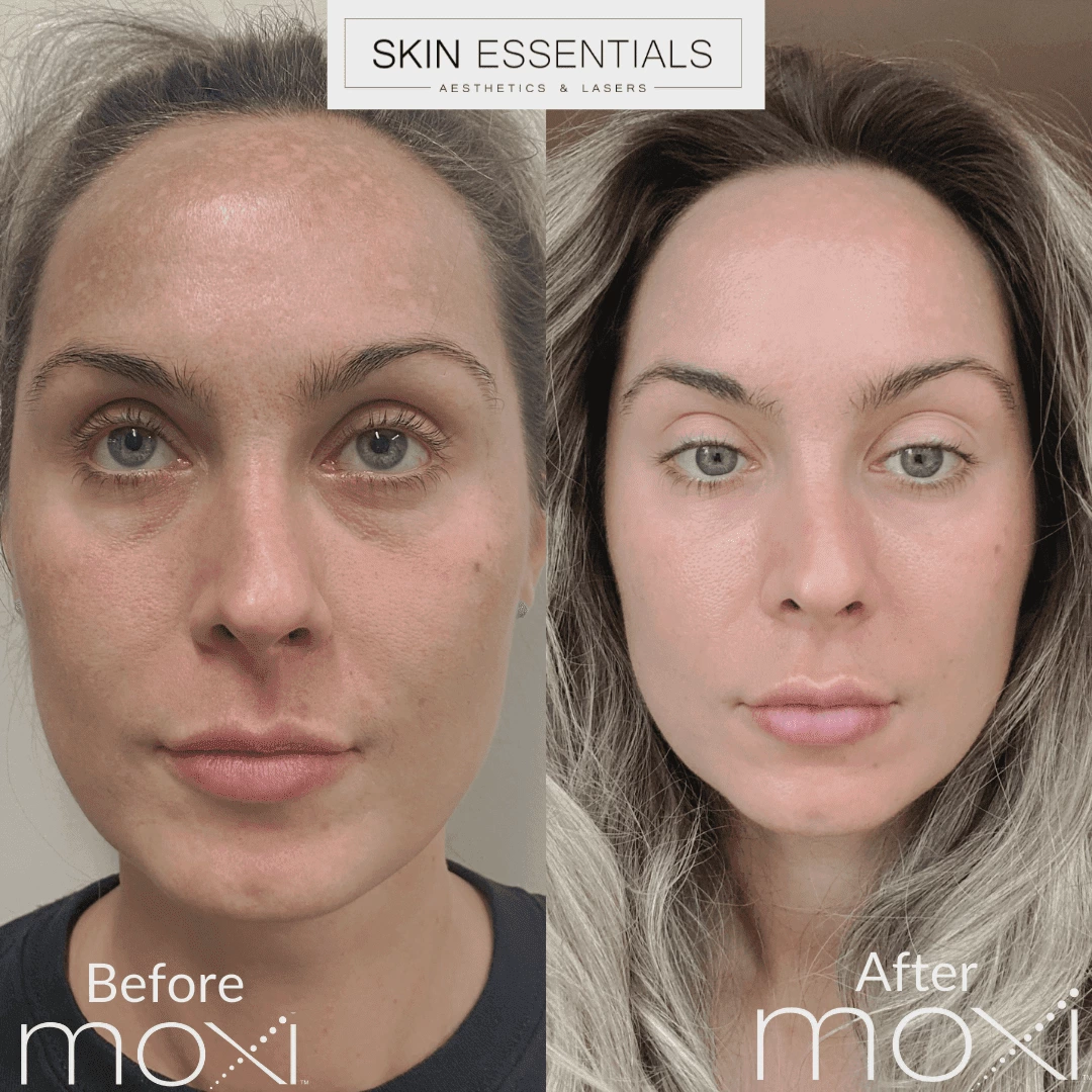 Before & After 1 Before & After 1